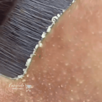 Limpieza Facial Homefunk Pro Ultrasónica